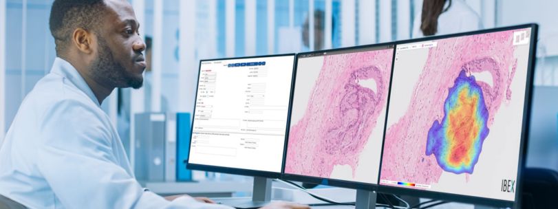 AI-based Cancer Screening Solution Banner