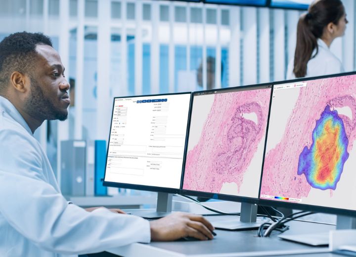 AI-based Cancer Screening Solution thumbnail