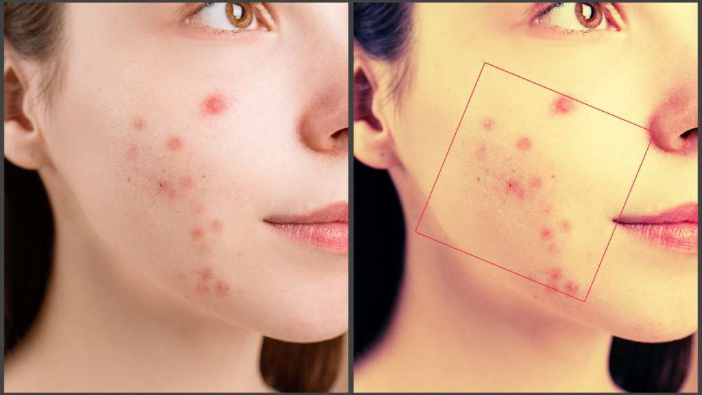 AI-powered Skin Analysis