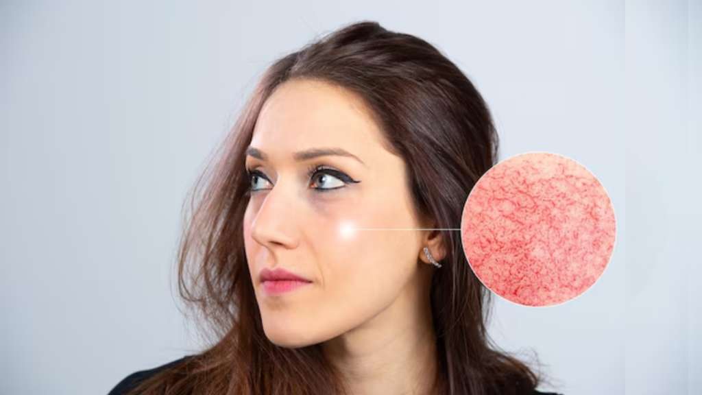 AI-enabled Specular Shine Analysis