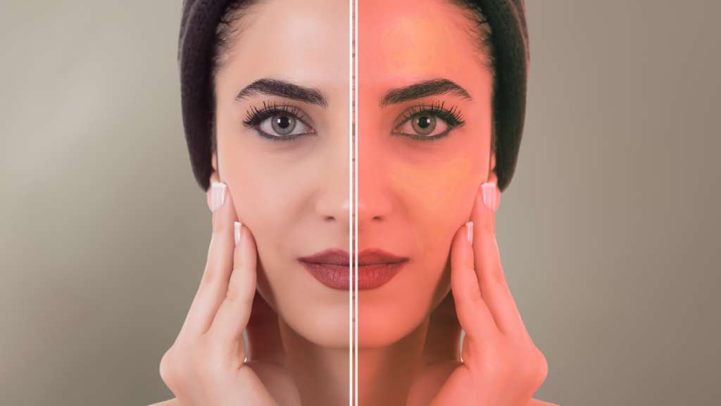 Yellowness Detection